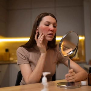 Vrouw spiegel rosacea